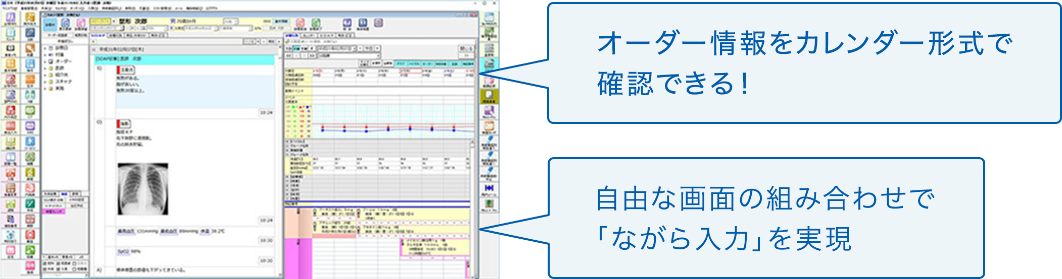 オーダー情報をカレンダー形式で確認できる！／自由な画面の組み合わせで「ながら入力」を実現